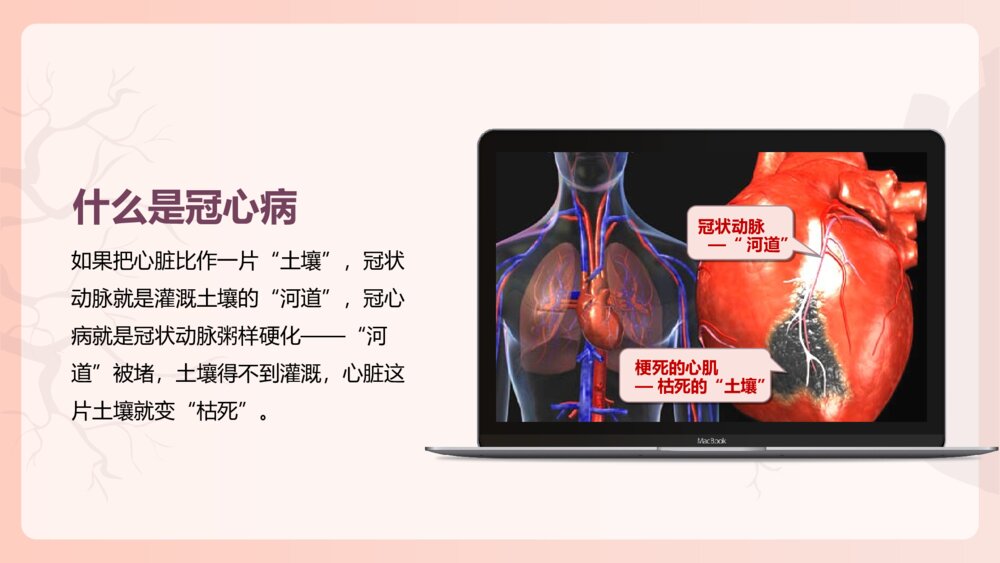 冠心病健康教育PPT模板4
