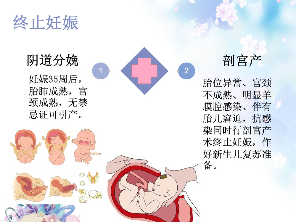 妇产科胎膜早破的护理措施ppt课件下载11