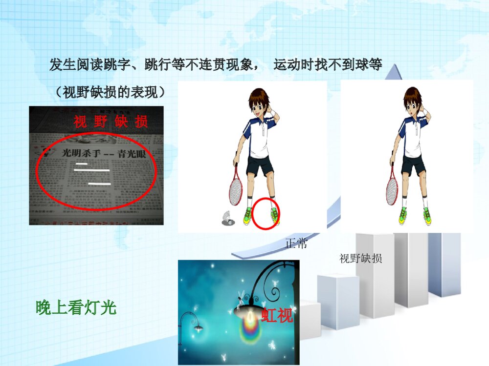 青光眼术后护理查房ppt课件下载6