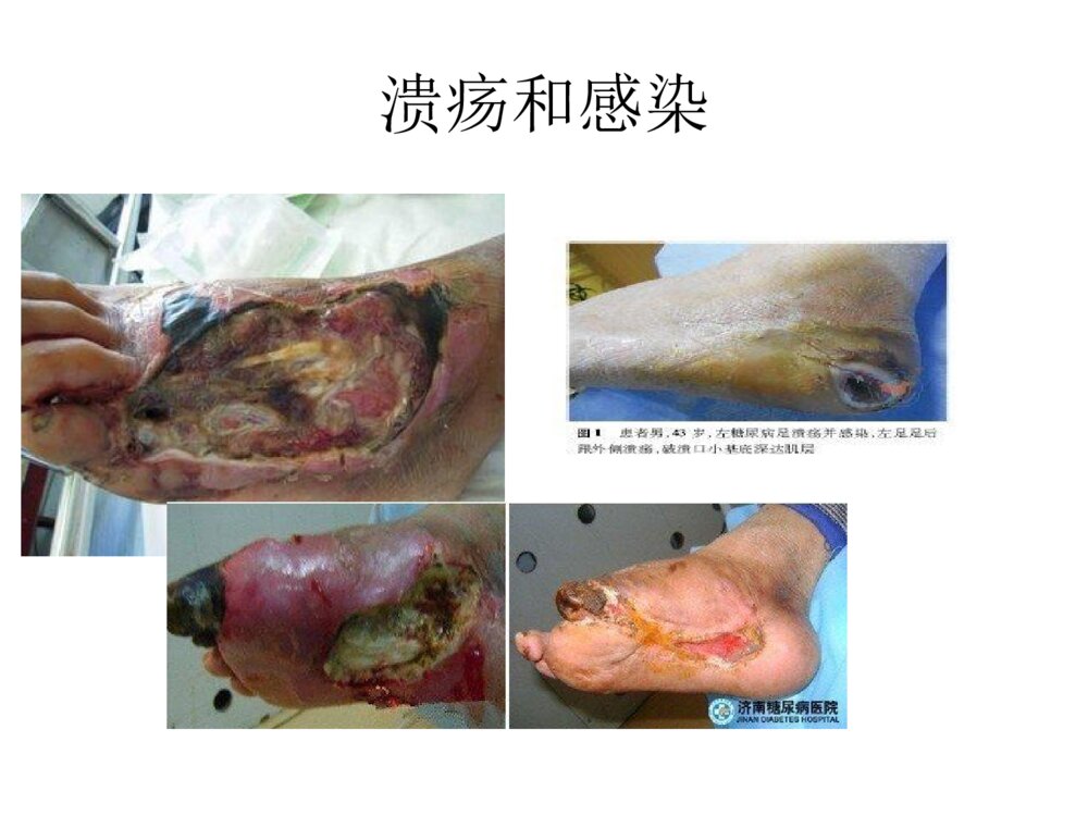 全国中医护理骨干培训分享ppt课件下载7