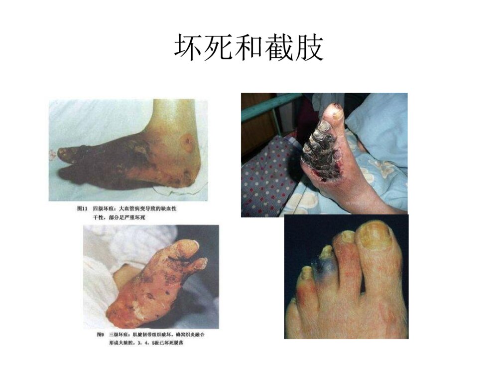全国中医护理骨干培训分享ppt课件下载8