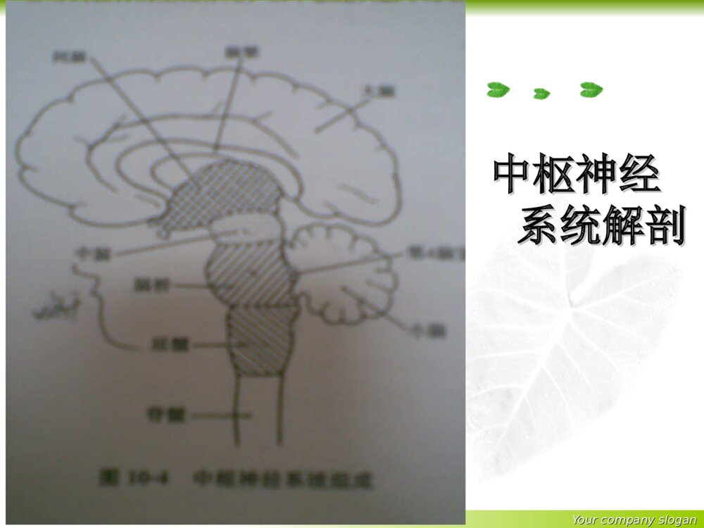 神经内科基础知识护理培训ppt课件下载5