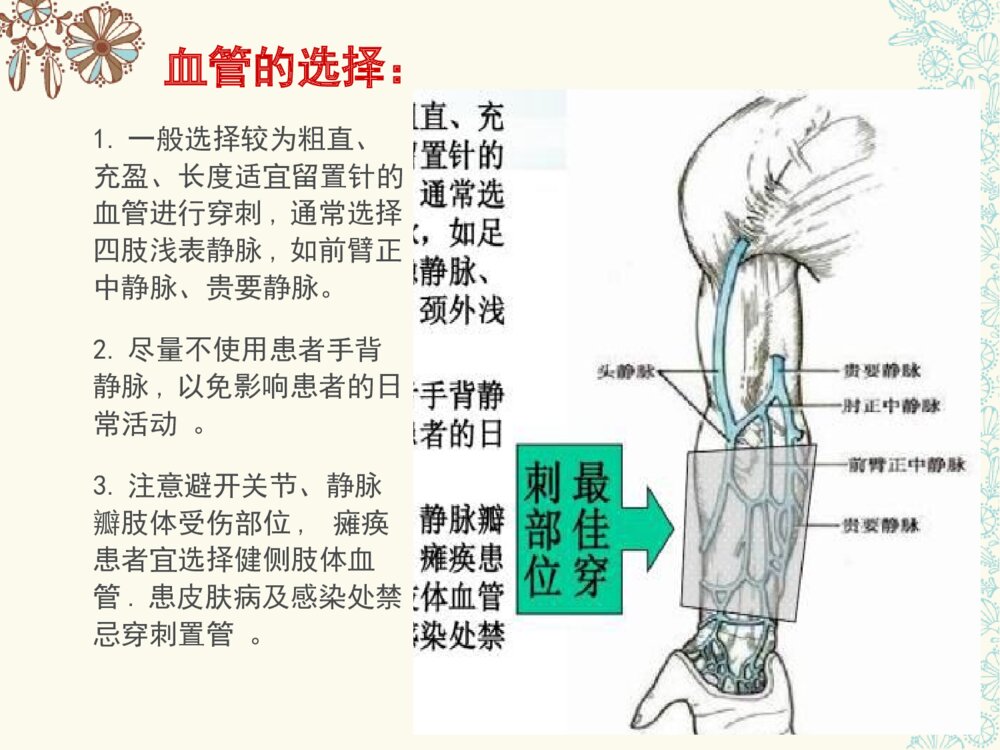 临床静脉留置针的护理查房ppt课件下载9