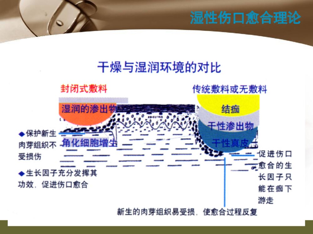 伤口护理新进展湿性愈合ppt课件下载9