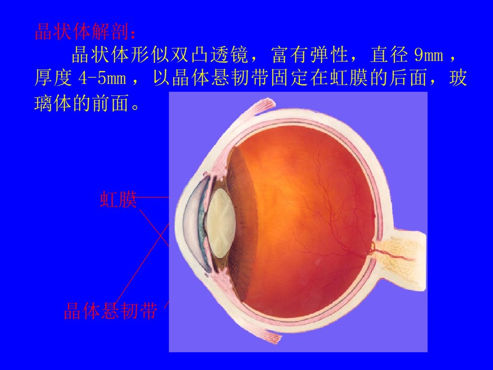 先天性晶状体半脱位患儿的护理查询ppt课件下载3