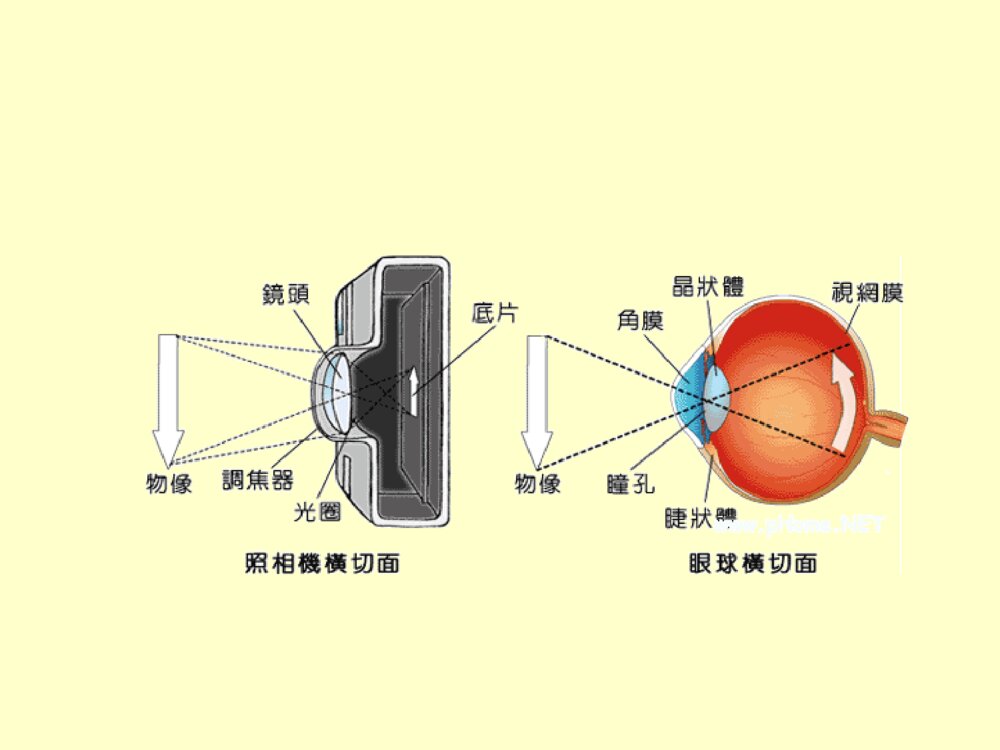 先天性晶状体半脱位患儿的护理查询ppt课件下载6