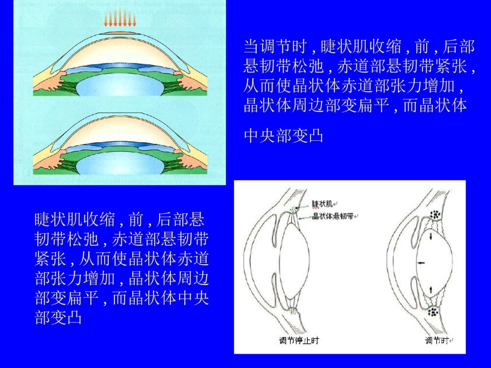 先天性晶状体半脱位患儿的护理查询ppt课件下载7