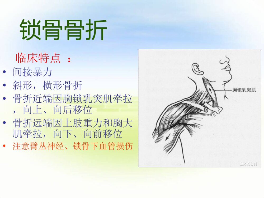 四肢骨折护理常规ppt课件下载3