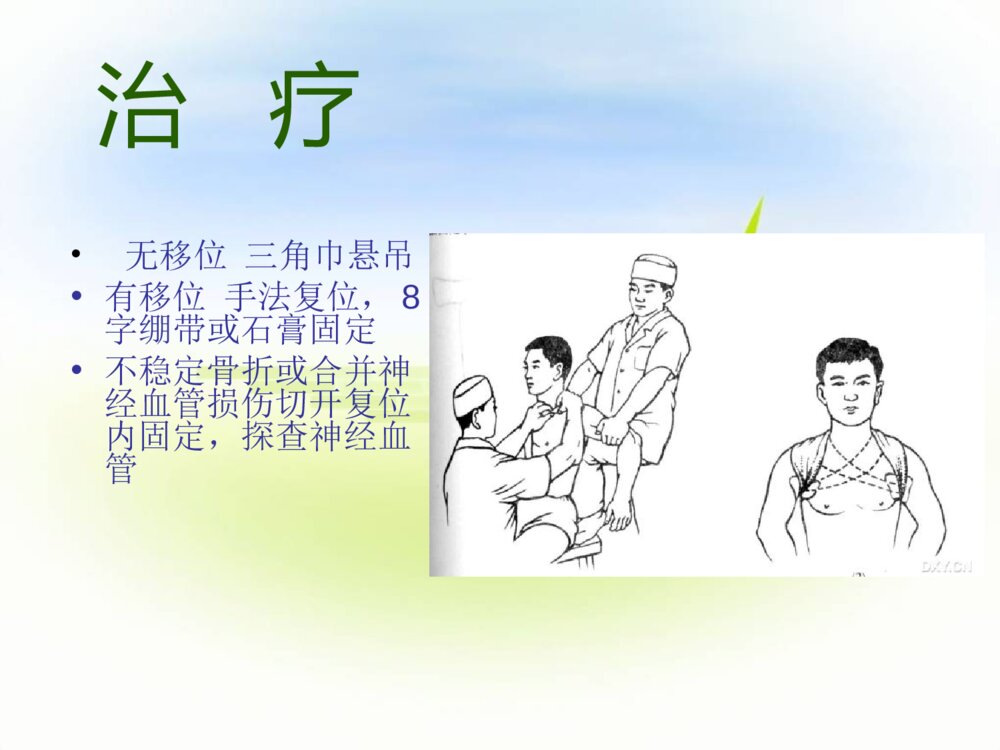 四肢骨折护理常规ppt课件下载4