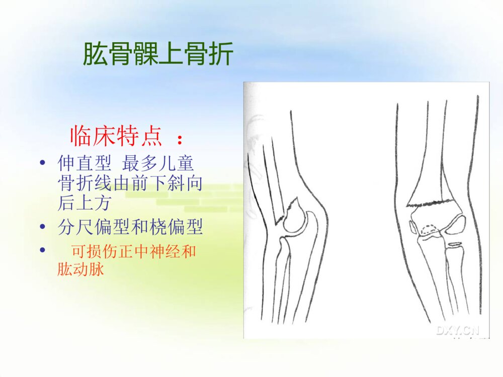 四肢骨折护理常规ppt课件下载5