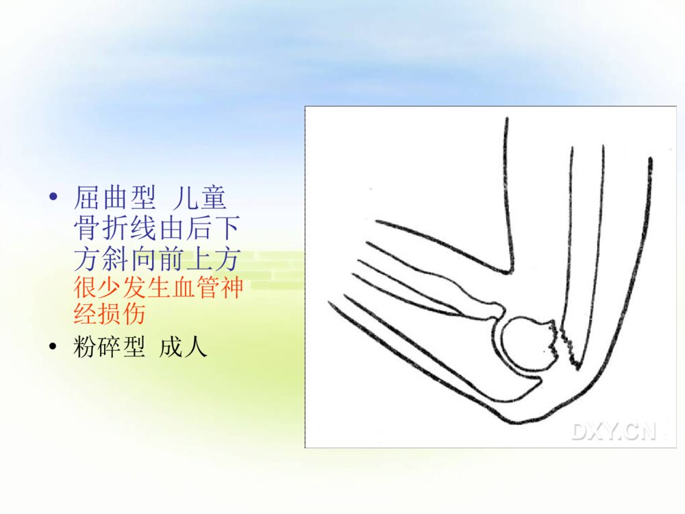 四肢骨折护理常规ppt课件下载6