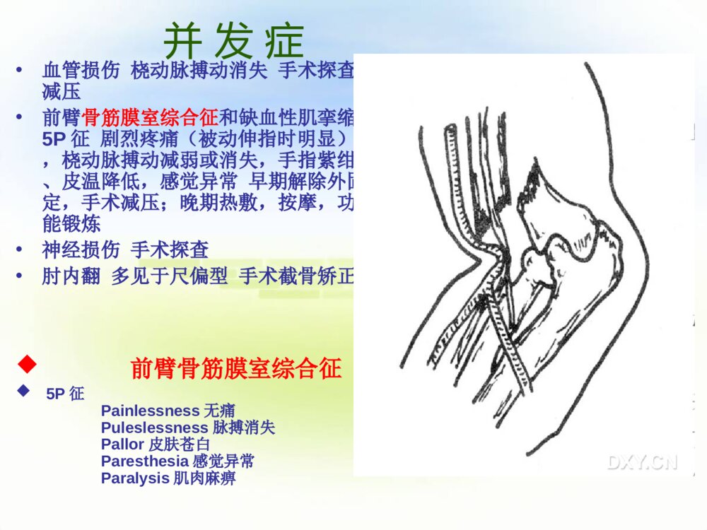 四肢骨折护理常规ppt课件下载8