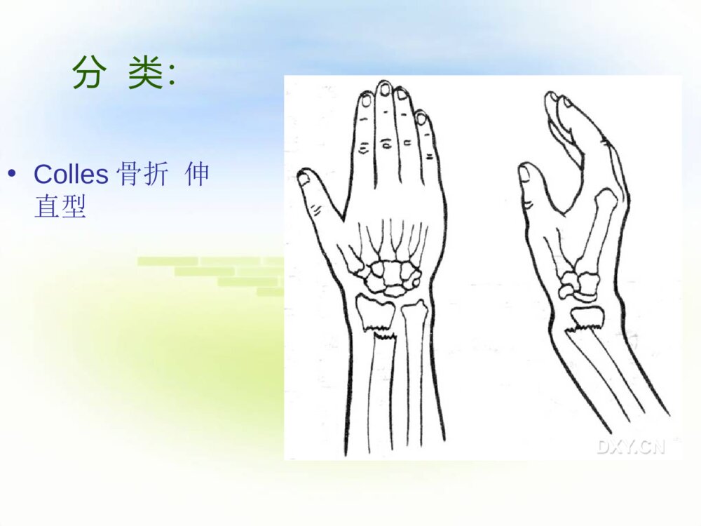 四肢骨折护理常规ppt课件下载10