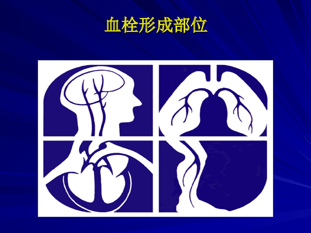 进修班血栓形成机制及抗栓药物作用靶点ppt课件下载6