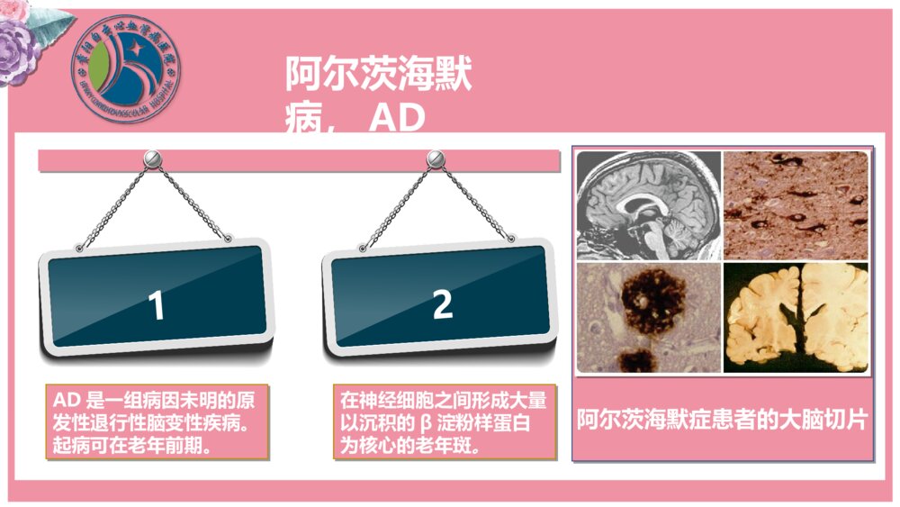老年痴呆病人的护理ppt课件6