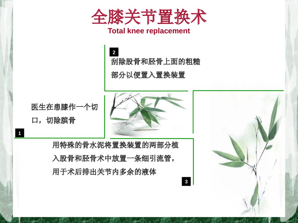 全膝关节置换术后护理查房ppt课件4