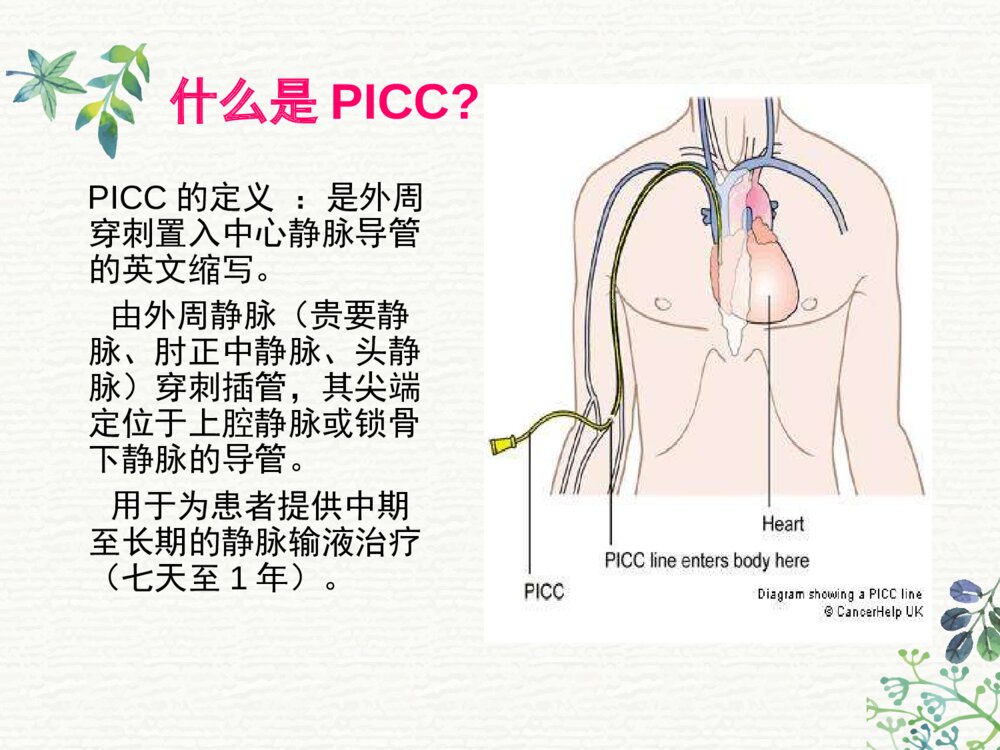 PICC外周穿刺置入中心静脉导管术后护理ppt课件3