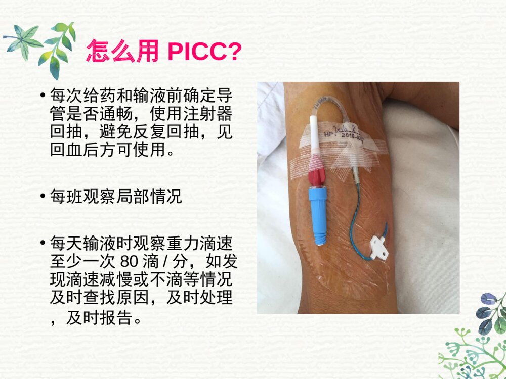 PICC外周穿刺置入中心静脉导管术后护理ppt课件8