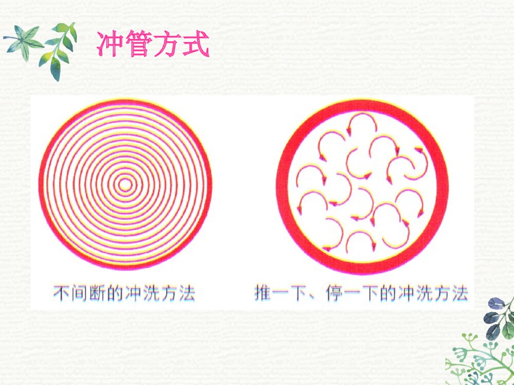 PICC外周穿刺置入中心静脉导管术后护理ppt课件10