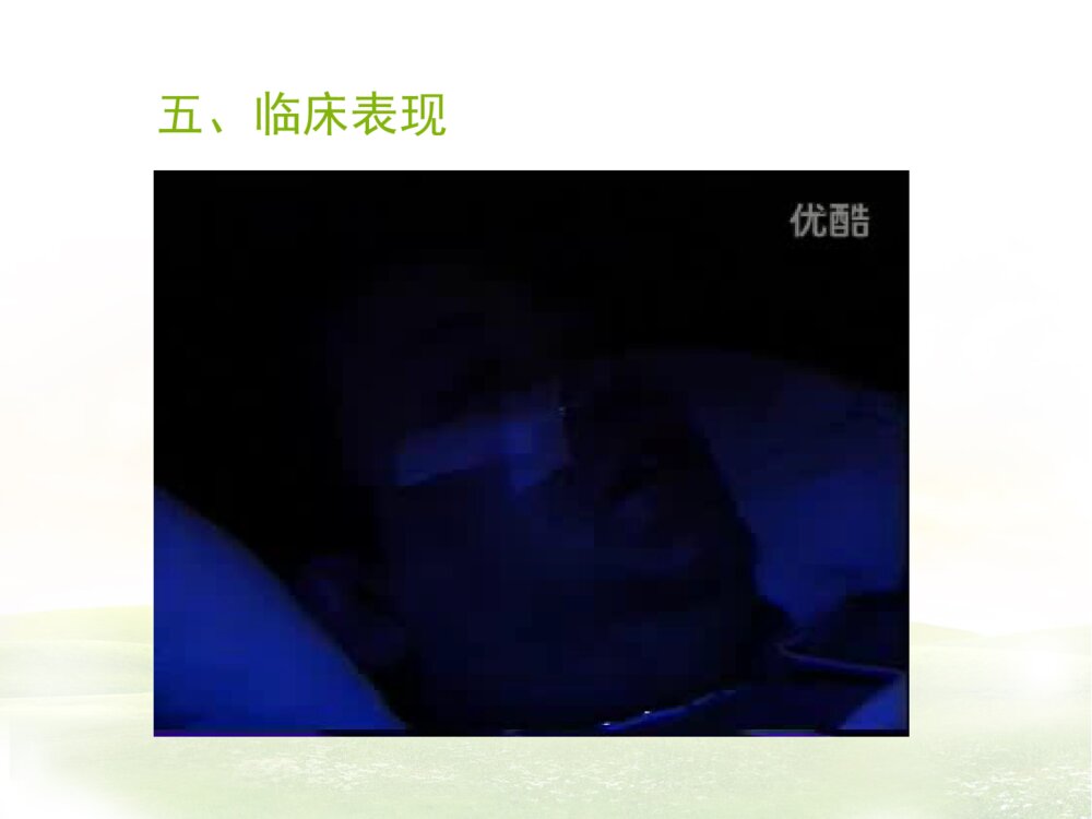 阻塞性睡眠呼吸暂停综合症ppt课件8