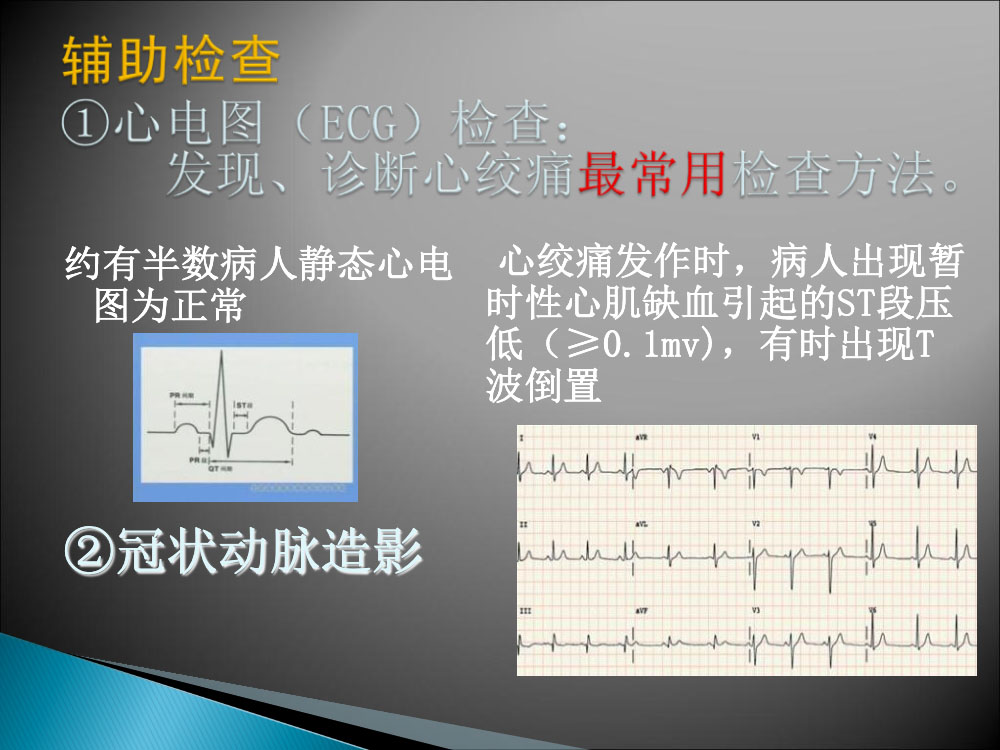 冠心病心绞痛病人的护理ppt课件9