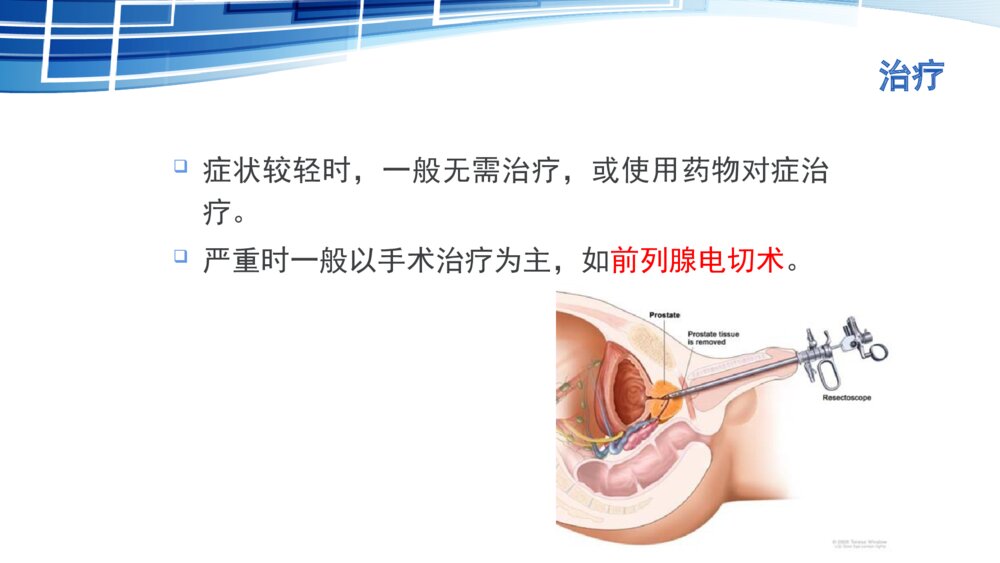 前列腺电切术后护理ppt课件下载5