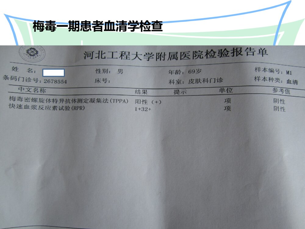 梅毒患者的护理ppt课件7