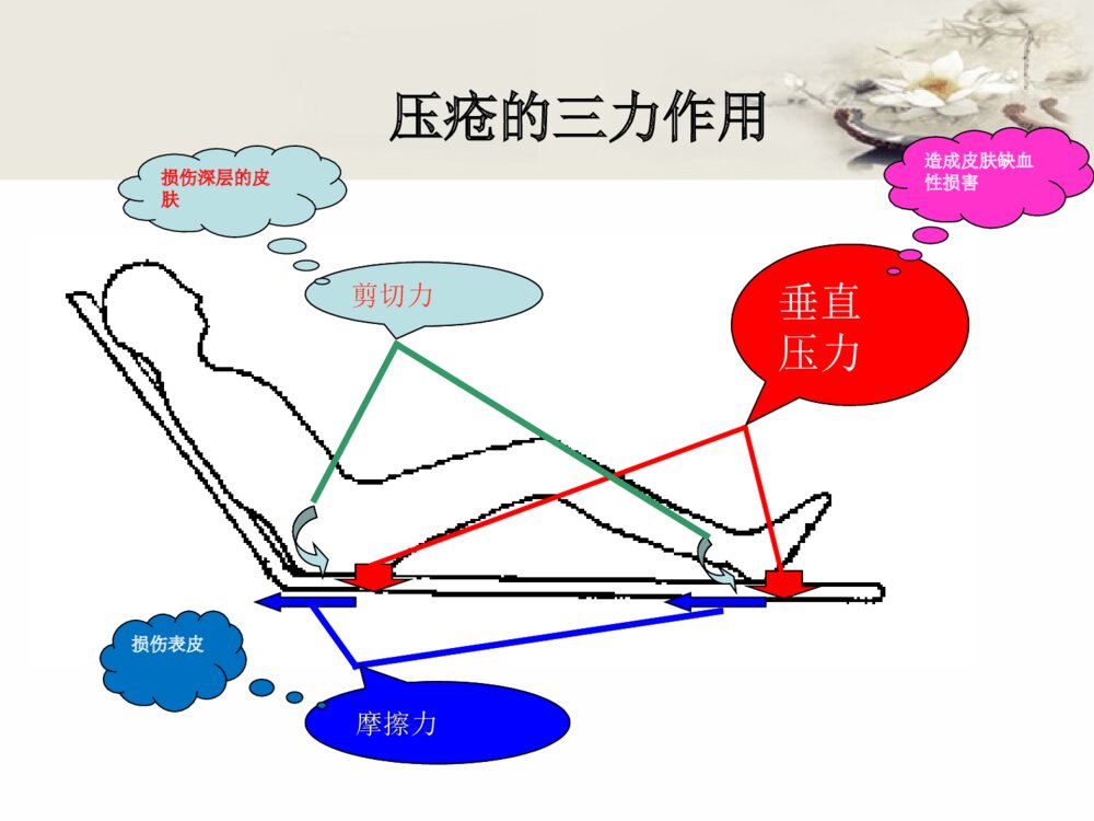 压疮预防及护理ppt课件下载5