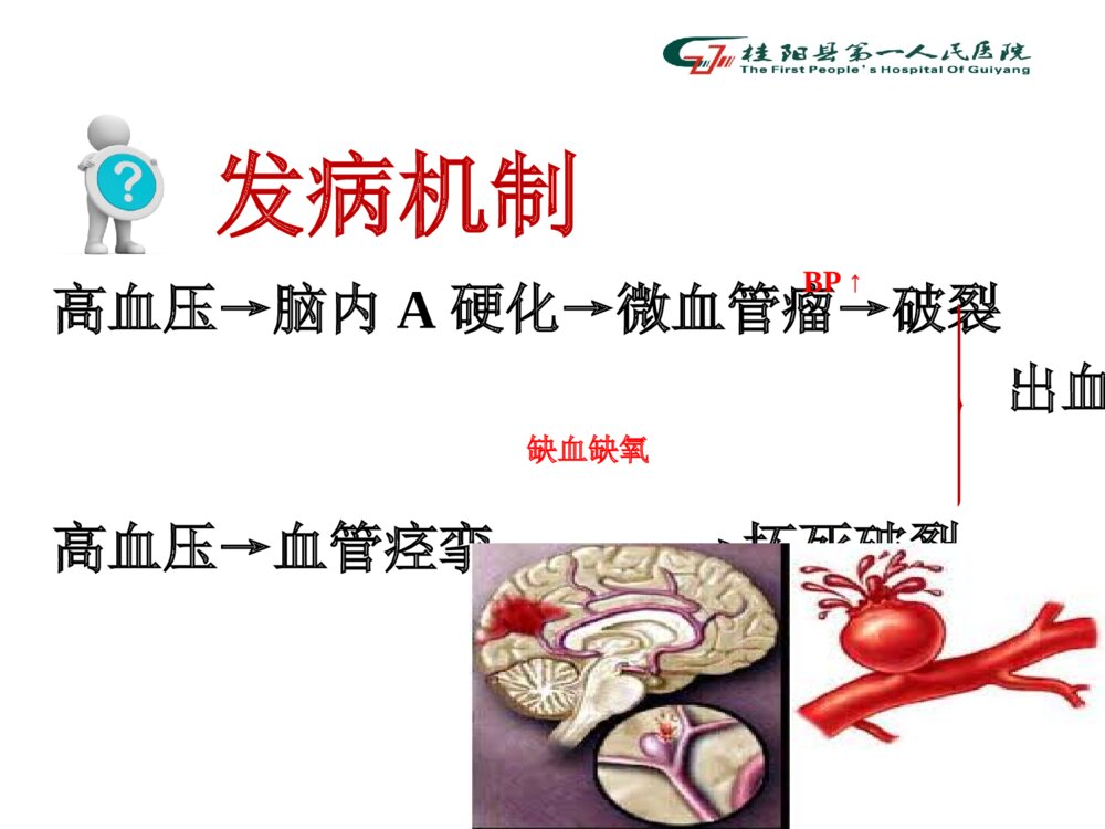 脑出血病人术后的护理查房ppt课件下载9