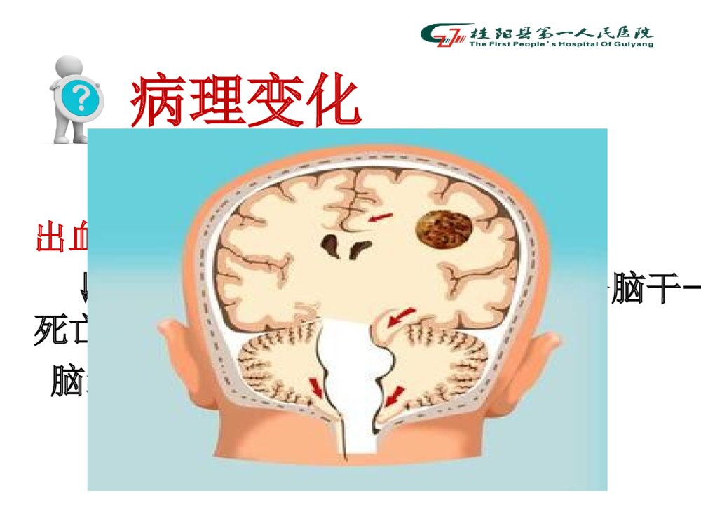 脑出血病人术后的护理查房ppt课件下载10