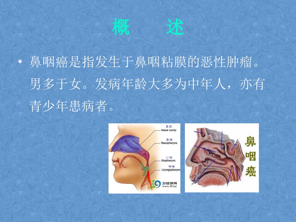 鼻咽癌患者的护理PPt课件下载3