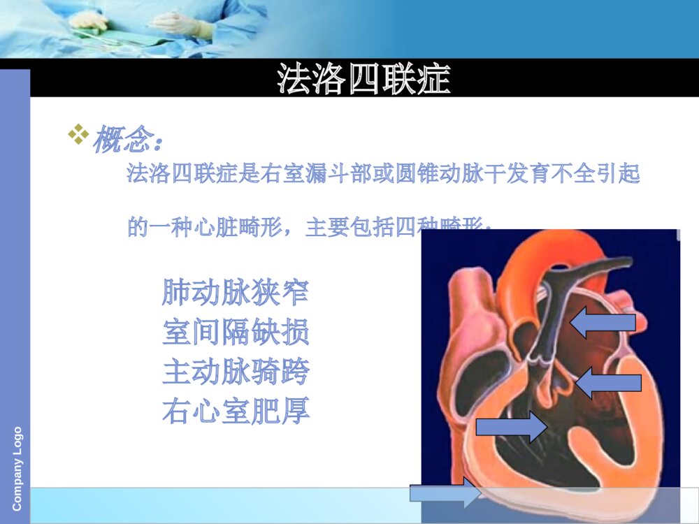 法洛四联症术前术后护理ppt课件下载2