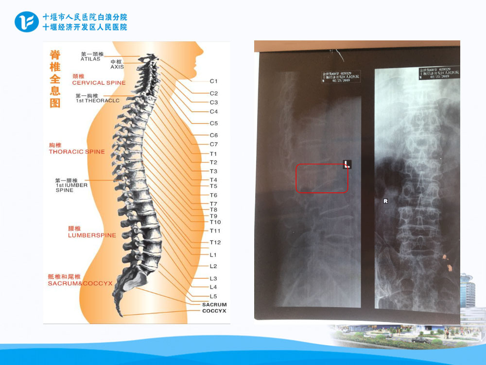 普外科护理疑难病例讨论ppt课件下载4