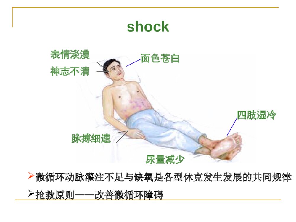 休克的相关知识及护理ppt课件下载4