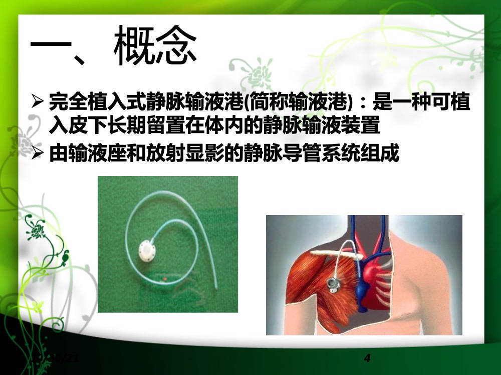 完全植入式静脉输液港的护理ppt课件下载4