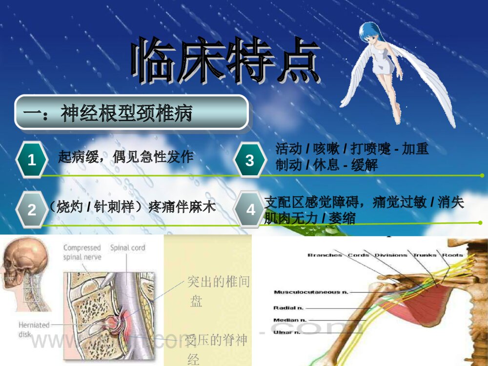 颈椎病护理常规ppt课件下载8