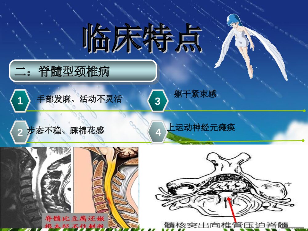 颈椎病护理常规ppt课件下载9
