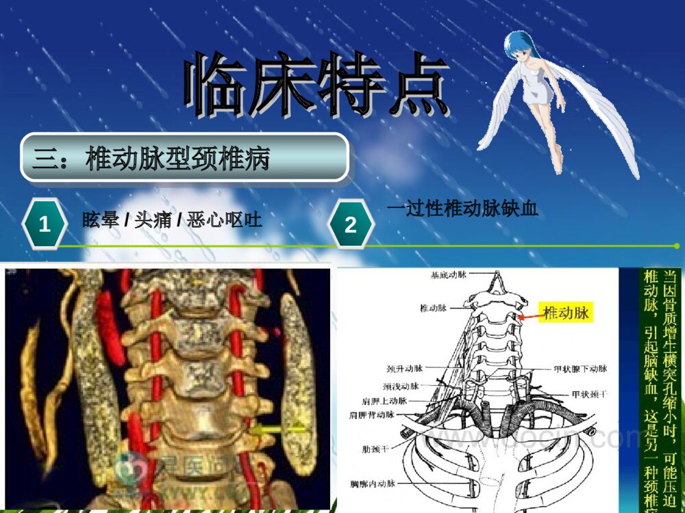 颈椎病护理常规ppt课件下载10