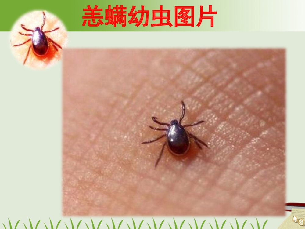 恙虫病的护理及案例ppt课件下载10