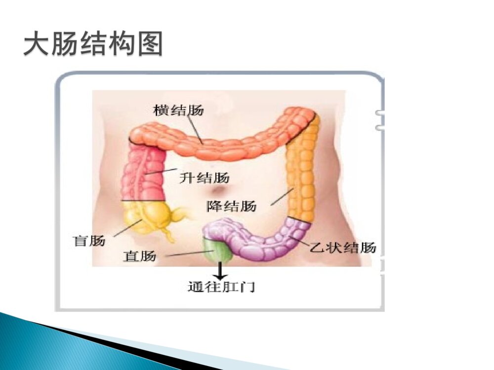 结肠息肉的护理ppt课件下载6