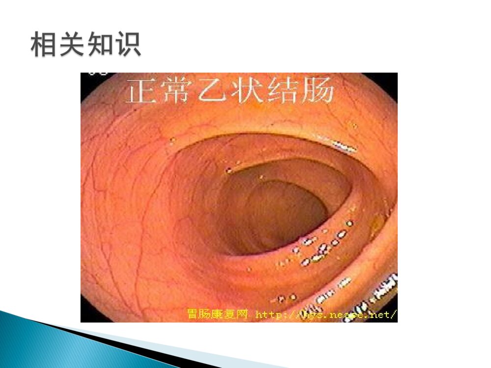 结肠息肉的护理ppt课件下载7