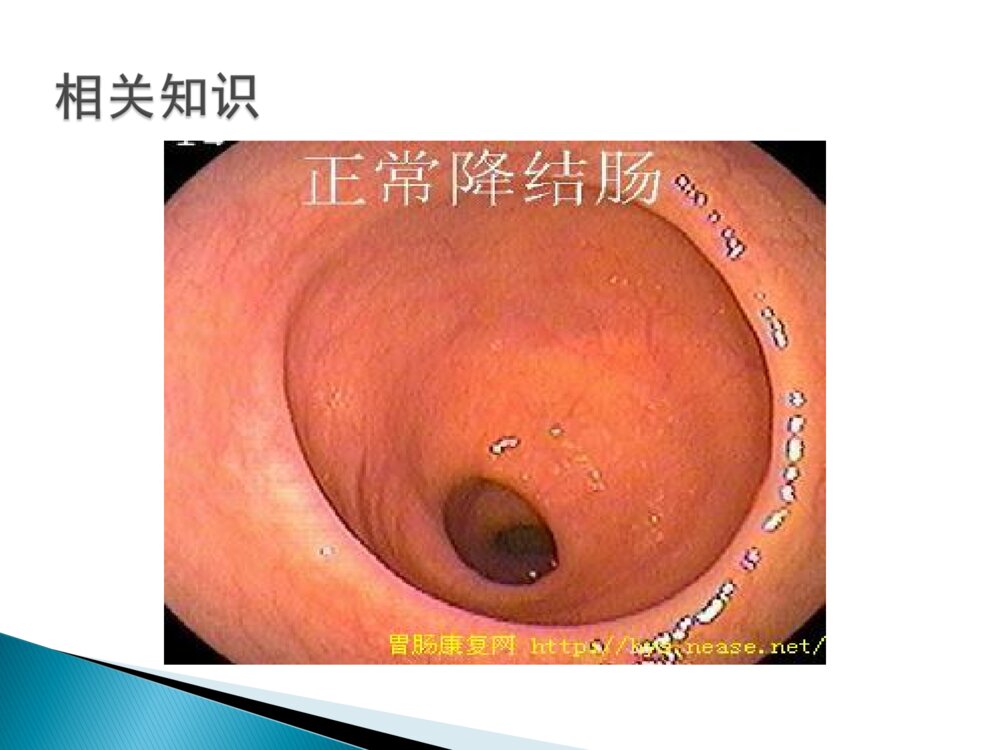 结肠息肉的护理ppt课件下载8