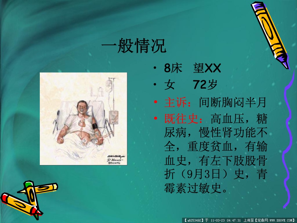 心绞痛的护理查房ppt课件下载2