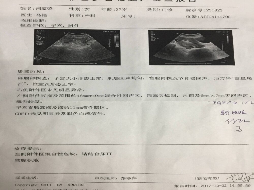 妇产科-异位妊娠的治疗与护理ppt课件下载6