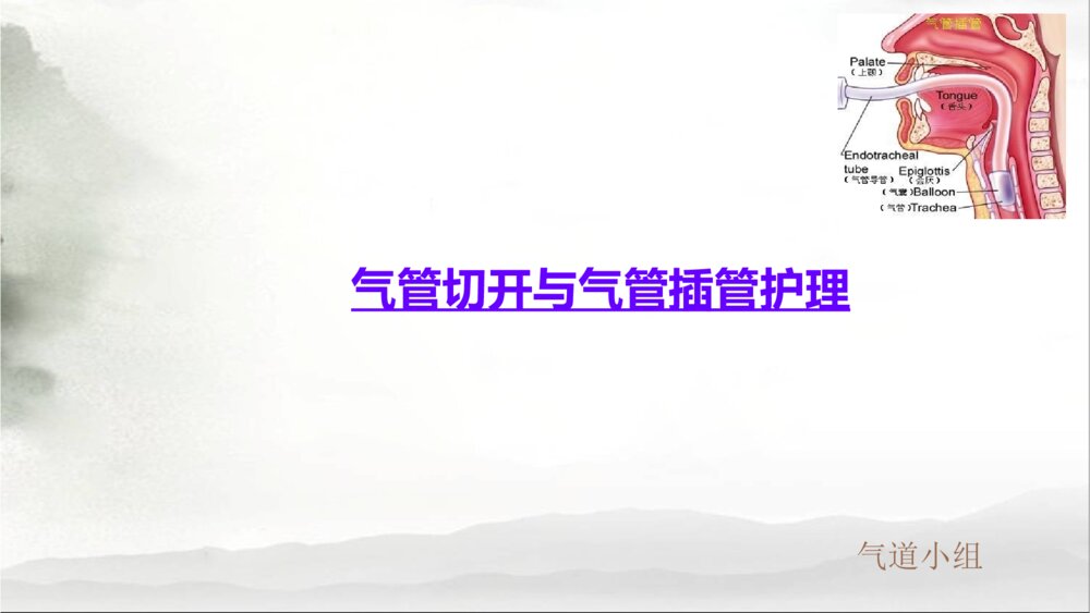 气管切开与气管插管护理ppt课件下载1
