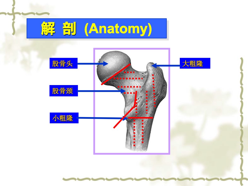 股骨颈骨骨折术后护理查房ppt课件下载9