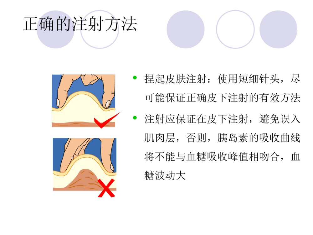 电脑血糖监测及胰岛素注射笔的使用方法ppt课件10