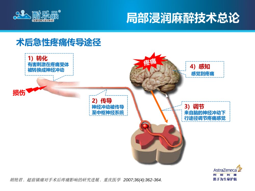 局部浸润麻醉技术操作指南腹部手术术后疼痛管理ppt课件8