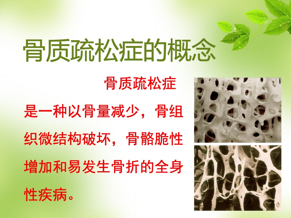 骨质疏松的科普ppt课件5