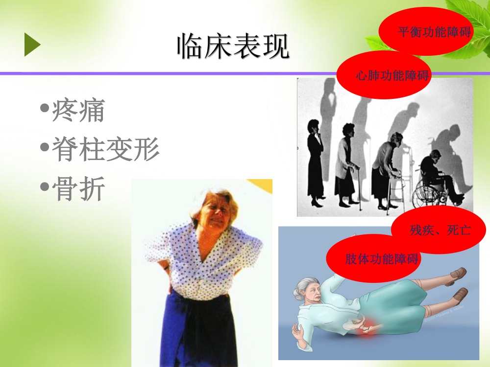 骨质疏松的科普ppt课件6